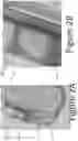 Fig. 03 - Mandibular advancement device with guide channel