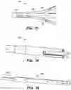 Fig. 11 - Variable stiffness flexure