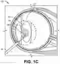 Fig. 04 - Method for eye lens removal using cavitating microbubbles