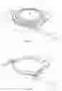 Fig. 02 - Apparatus and methods for treating excess intraocular fluid