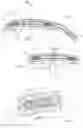 Fig. 04 - Apparatus and methods for treating excess intraocular fluid