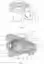 Fig. 05 - Apparatus and methods for treating excess intraocular fluid