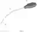 Fig. 06 - Apparatus and methods for treating excess intraocular fluid