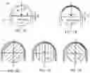 Fig. 07 - Apparatus and methods for treating excess intraocular fluid