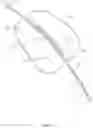 Fig. 08 - Apparatus and methods for treating excess intraocular fluid