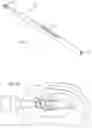 Fig. 09 - Apparatus and methods for treating excess intraocular fluid