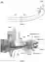 Fig. 04 - Automatic cerumen removing device
