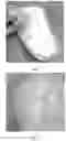 Fig. 05 - DISPOSABLE HYGIENE ABSORBENT PRODUCT