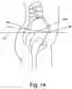 Fig. 15 - Adjustable ergonomic chair
