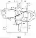 Fig. 21 - System and method for moving, turning, and positioning a patient