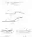 Fig. 02 - Lumbar traction device