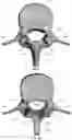 Fig. 09 - Device for releasing spinal contractures and associated methods
