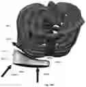 Fig. 100 - Device for releasing spinal contractures and associated methods
