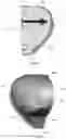 Fig. 101 - Device for releasing spinal contractures and associated methods