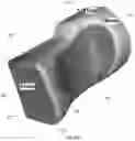 Fig. 113 - Device for releasing spinal contractures and associated methods