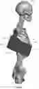 Fig. 114 - Device for releasing spinal contractures and associated methods