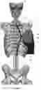 Fig. 115 - Device for releasing spinal contractures and associated methods
