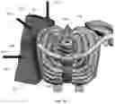 Fig. 116 - Device for releasing spinal contractures and associated methods
