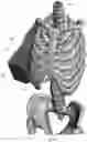 Fig. 118 - Device for releasing spinal contractures and associated methods