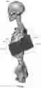 Fig. 122 - Device for releasing spinal contractures and associated methods