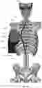 Fig. 123 - Device for releasing spinal contractures and associated methods