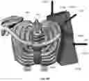 Fig. 124 - Device for releasing spinal contractures and associated methods
