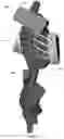 Fig. 142 - Device for releasing spinal contractures and associated methods