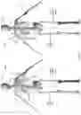 Fig. 21 - Device for releasing spinal contractures and associated methods