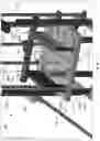 Fig. 37 - Device for releasing spinal contractures and associated methods