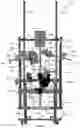 Fig. 54 - Device for releasing spinal contractures and associated methods