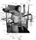 Fig. 74 - Device for releasing spinal contractures and associated methods