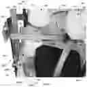 Fig. 76 - Device for releasing spinal contractures and associated methods