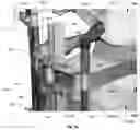 Fig. 77 - Device for releasing spinal contractures and associated methods