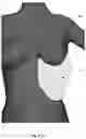 Fig. 94 - Device for releasing spinal contractures and associated methods