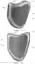 Fig. 96 - Device for releasing spinal contractures and associated methods