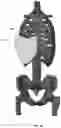 Fig. 98 - Device for releasing spinal contractures and associated methods