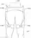 Fig. 01 - Method and device for controlling walking assist device