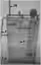 Fig. 01 - Vertical decompression relaxation device