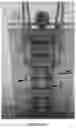 Fig. 02 - Vertical decompression relaxation device