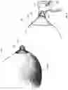 Fig. 02 - Custom-made artificial nipple