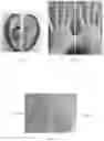Fig. 03 - SKIN CARE COMPOSITIONS AND METHODS