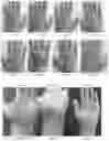 Fig. 05 - SKIN CARE COMPOSITIONS AND METHODS