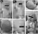 Fig. 01 - Methods and compositions to prevent and treat disorders associated with mutations in the ODC1 gene