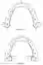 Fig. 05 - Pharmaceutical suspensions containing drug particles, devices for their administration, and methods of their use