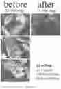 Fig. 28 - Pharmaceutical suspensions containing drug particles, devices for their administration, and methods of their use