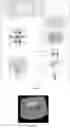 Fig. 34 - Pharmaceutical suspensions containing drug particles, devices for their administration, and methods of their use