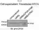 Fig. 17 - Compositions and methods for adoptive cell therapy for cancer