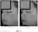 Fig. 20 - Biologic preserving composition and methods of use