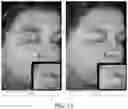 Fig. 22 - Biologic preserving composition and methods of use