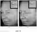 Fig. 23 - Biologic preserving composition and methods of use